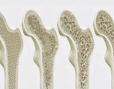 CANADI Clínica especializada en Diabetes y Endocrinología en Hidalgo